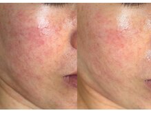 ウノ アッベリーナ(UNO × abbel'lina)/トロイアルケ#トロイピール#出雲