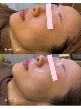 ギルドハナレ(GUILD HANARE)/"ダクトーピール×プラズマ"