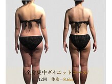 サンテボーテ(Sante Beaute)/背中の歪み・肩甲骨だし