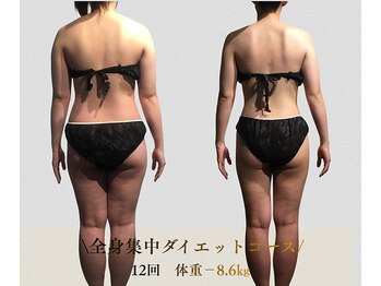 サンテボーテ(Sante Beaute)/背中の歪み・肩甲骨だし