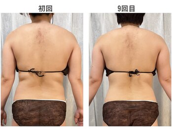 ヨサパーク ルルア(YOSA PARK Lulua)の写真/【痩せない原因に集中アタック!】進化系よもぎ蒸し×深部リンパマッサージで温活痩身◎理想の美ボディへ