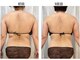 ヨサパーク ルルア(YOSA PARK Lulua)の写真/【痩せない原因に集中アタック!】進化系よもぎ蒸し×深部リンパマッサージで温活痩身◎理想の美ボディへ