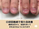 初回施術で見た目改善が可能です