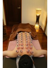 リラクゼーション アロ(ALO)/カッピング