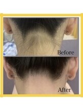 アルゴ 太田店(ALGO)/ WAX人気パーツ第２位はうなじ！