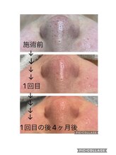 ジェミー(Gemmy)/