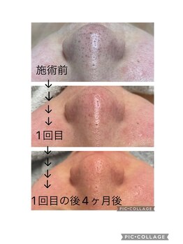 ジェミー(Gemmy)/