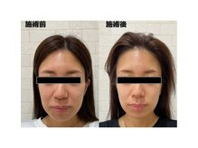 楽美身/お肌のトーンアップ