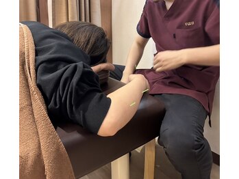 りはり/施術風景