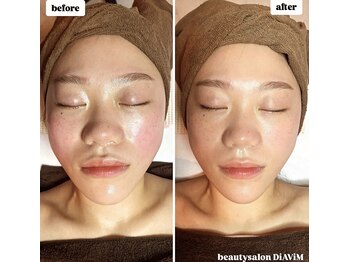 ディアビム(DiAViM)