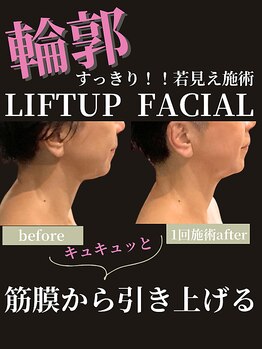 ノーブルノアール(Noble noir)/たるみすっきりリフト♪