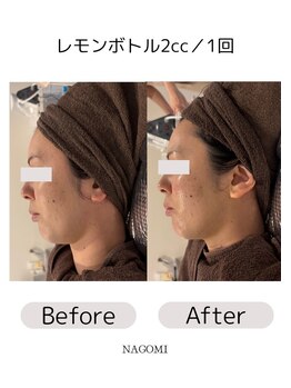 なごみ/脂肪分解【レモンボトル】