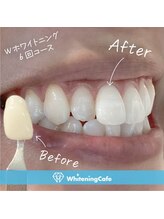 ホワイトニングカフェ 千葉店/ホワイトニングビフォーアフター
