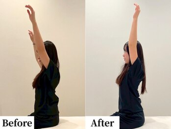 ソレア(Solea)/肩こり・ストレートネック1回目