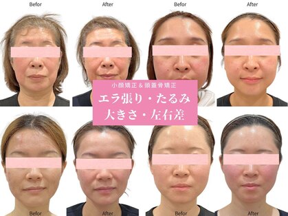 グレースエール トータルビューティーサロン(Grace Aile)の写真