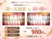 エクシアホワイトニング 盛岡中央通店