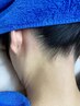 【レディース】【脱毛】ブラジリアンワックス脱毛　うなじ＋首セット　5500円