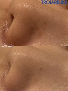 セレニテ(Serenite)/