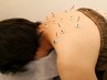 人気No.2【美容鍼×全身施術】★肩こり腰痛とお肌悩みも解決★¥10500→