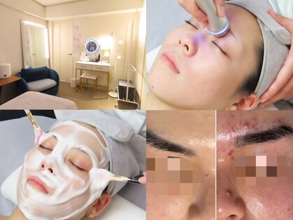 オルゥオルゥ(Olu-.olu.)の写真