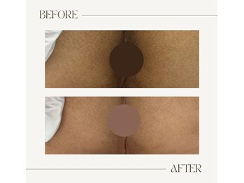 サロンウム(Salon umu)/Ｏラインのケアされてますか？