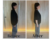 整体ラルース 中目黒(LALUZ)/40代　女性　猫背、巻き肩改善