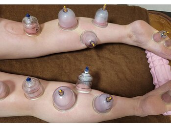 韓国 カッピング 吸い玉専門店 ラボ/足カッピングとリンパ流しw効果