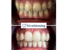 NAホワイトニング 船橋店の雰囲気（セルフホワイトニングでも理想の白さに!船橋ホワイトニング/千葉）