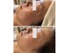 サロン リノ(salon rino)の写真