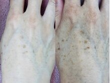 サロンドノア(Salon de Noah)の雰囲気（【手のシミにも効果】コラーゲンが増えしわも減りふっくら◎）