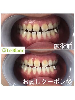 ルブラン 奈良店(Le Blanc)/タバコのヤニ、汚れ落とすぞ!!