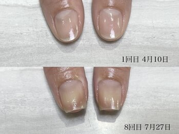 ロイ(LOI)/自爪育成コース