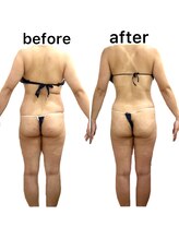 フローレンス(Florence)/30代○○さんの変化　