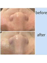 ミアローザ(Mia Rosa)/トーンアップ効果も