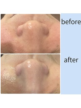 ミアローザ(Mia Rosa)/トーンアップ効果も