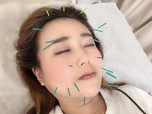 TK鍼灸院/変わるを実感！