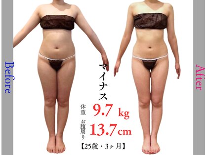 キレイ(KIREI)の写真