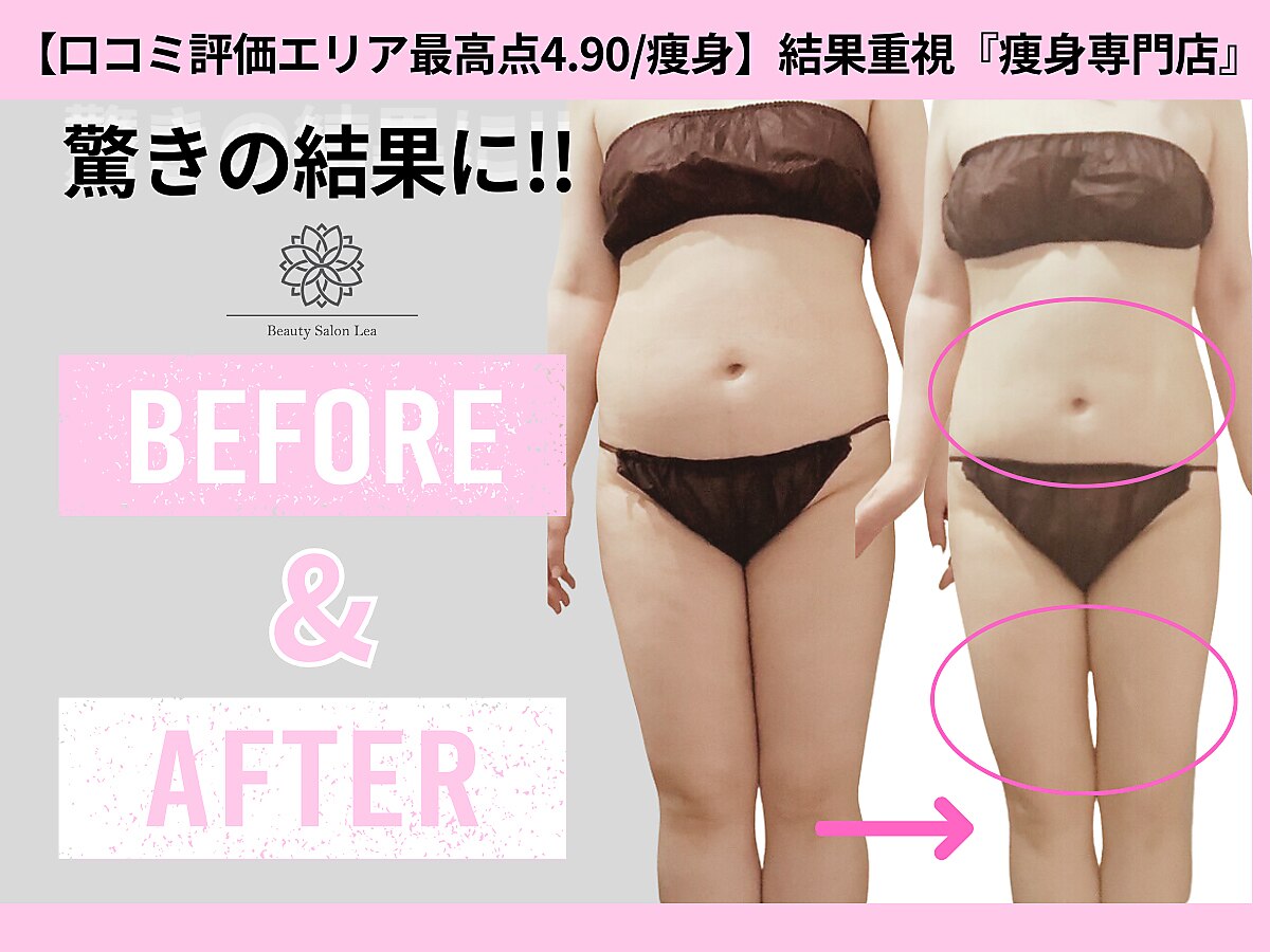 上野エステサロン レア(Lea)｜ホットペッパービューティー