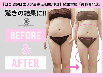上野エステサロン レア(Lea)の写真