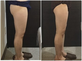 美容整体ウェリナ あま甚目寺院/小顔矯正/骨盤矯正/美脚サロン