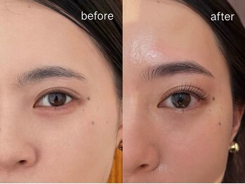 ネストアイ(NEST eye)