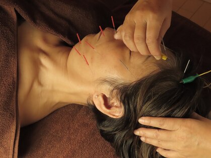 フェルーシュ鍼灸 銀座(Feruche)の写真