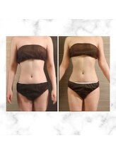 エムズ ビューティー サロン(M's Beauty Salon)/ビフォーアフター