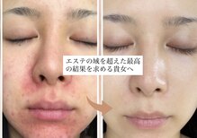 ナオフクオカ ヒーリングフォースエヌ(NaoFukuoka/healingforceN)