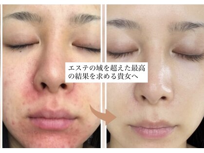 ナオフクオカ ヒーリングフォースエヌ(NaoFukuoka/healingforceN)の写真