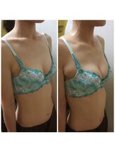 ロータス(Lotus)/40代　(左)ビフォー(右)アフター