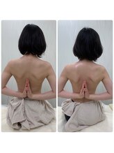 ソルニス(Solnis.)/痩身☆脂肪分解/ハイパーナイフ