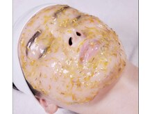 リンカ(Rinca)/ハイドロジェリー/フェイシャル