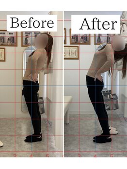 ナオル整体 仙台長町院(NAORU整体)/整体・矯正ビフォーアフター