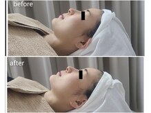 デサフィオ(Desafio)/before→after